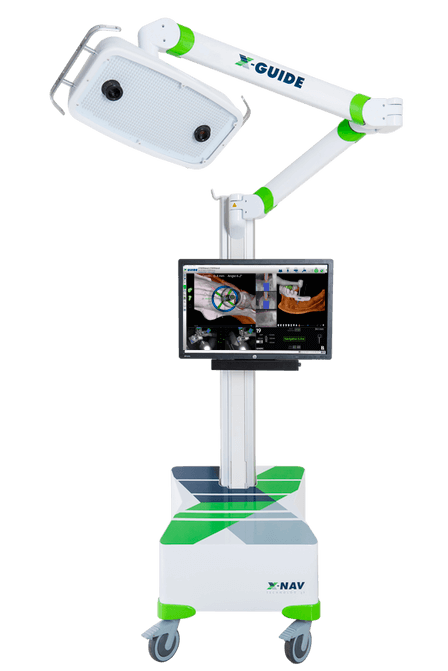 X-nav guided implant placement