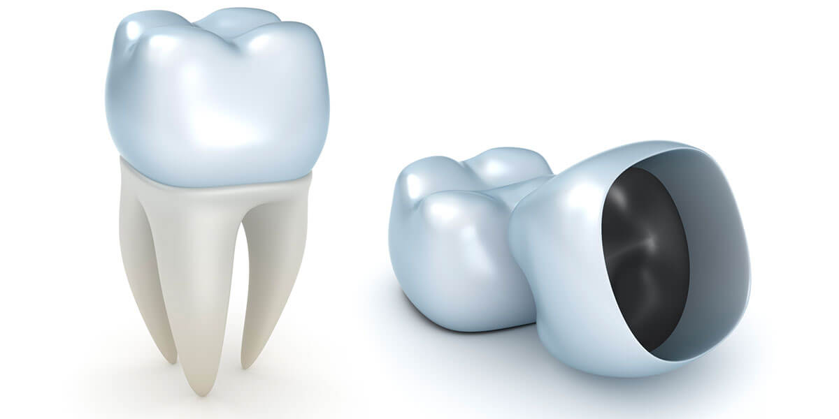 Decorative Photo CAD/CAM Dentistry